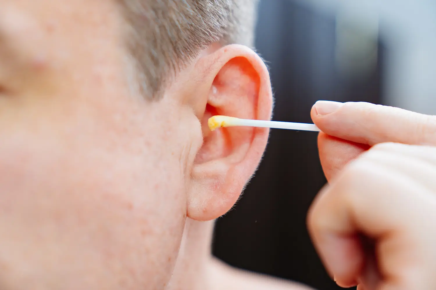 Removing earwax from ear