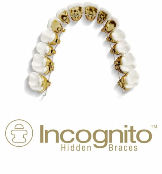 incognito incognito